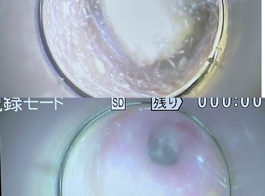 川崎でリラクゼーションをご提供する耳そうじスコープサロン耳癒のブログ